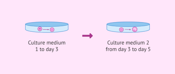What Does Sequential Embryo Culture Look Like 