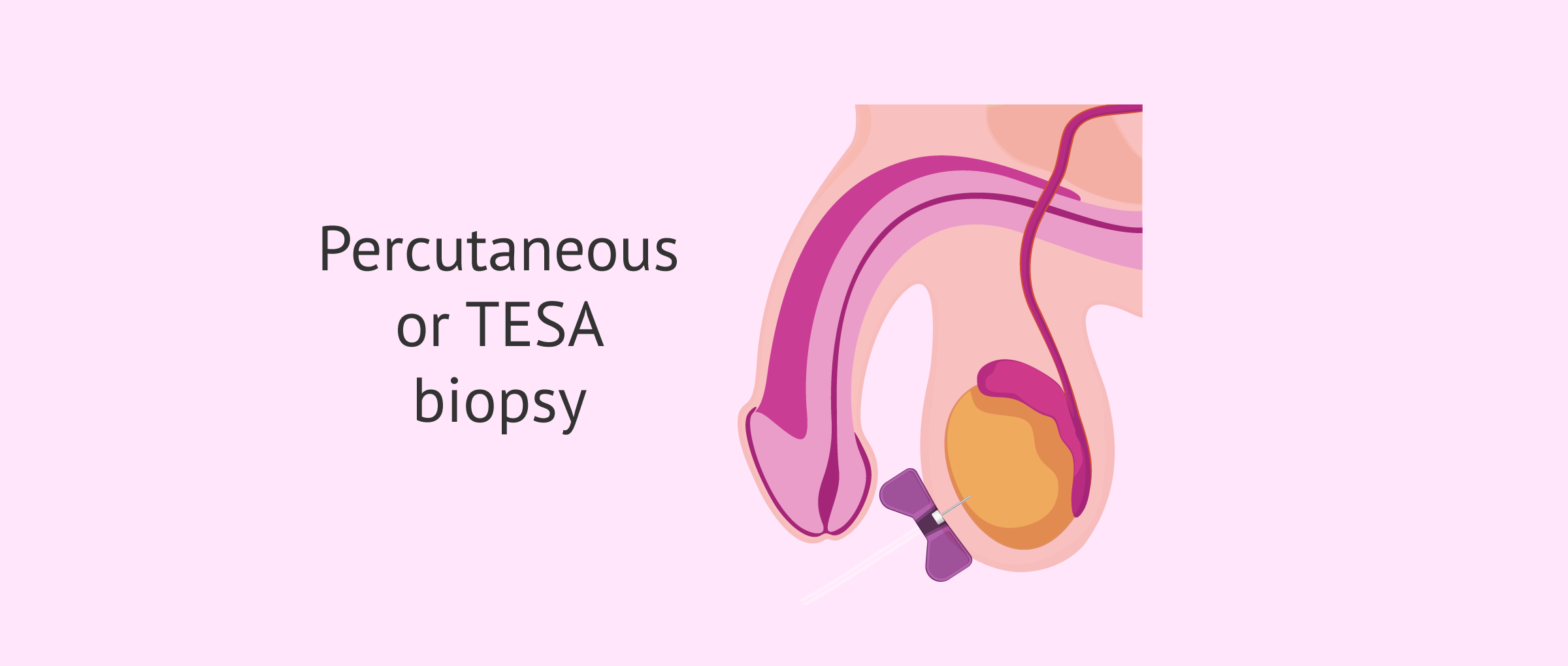 percutaneous-tesa-biopsy