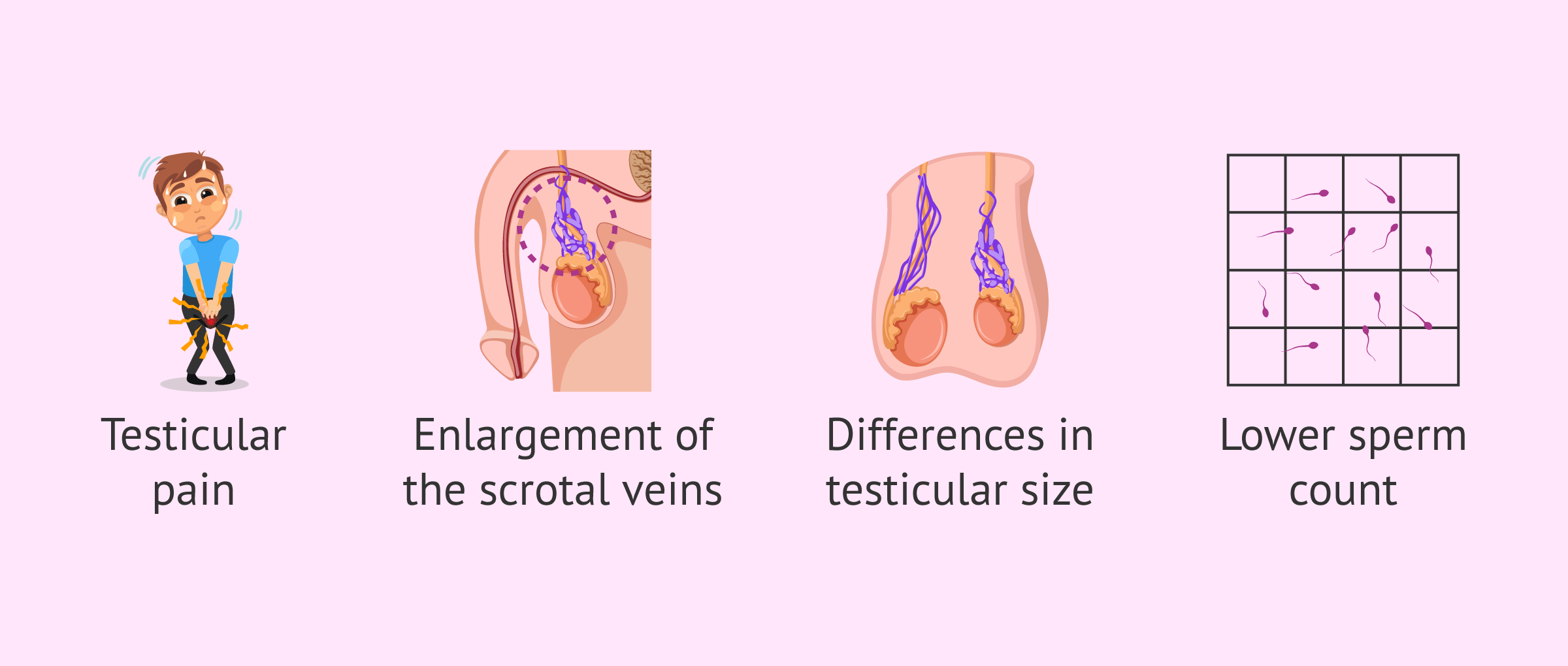 What is a Varicocele? - Causes, Symptoms & Treatment