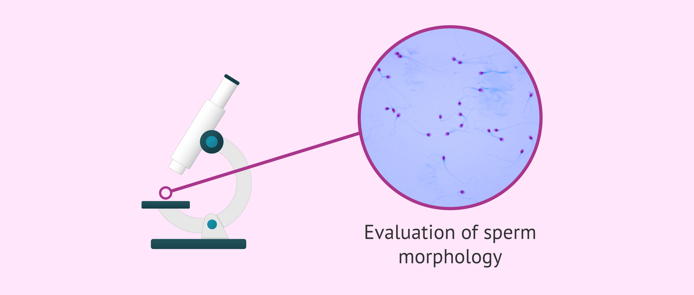 Imagen: Evaluating sperm morphology