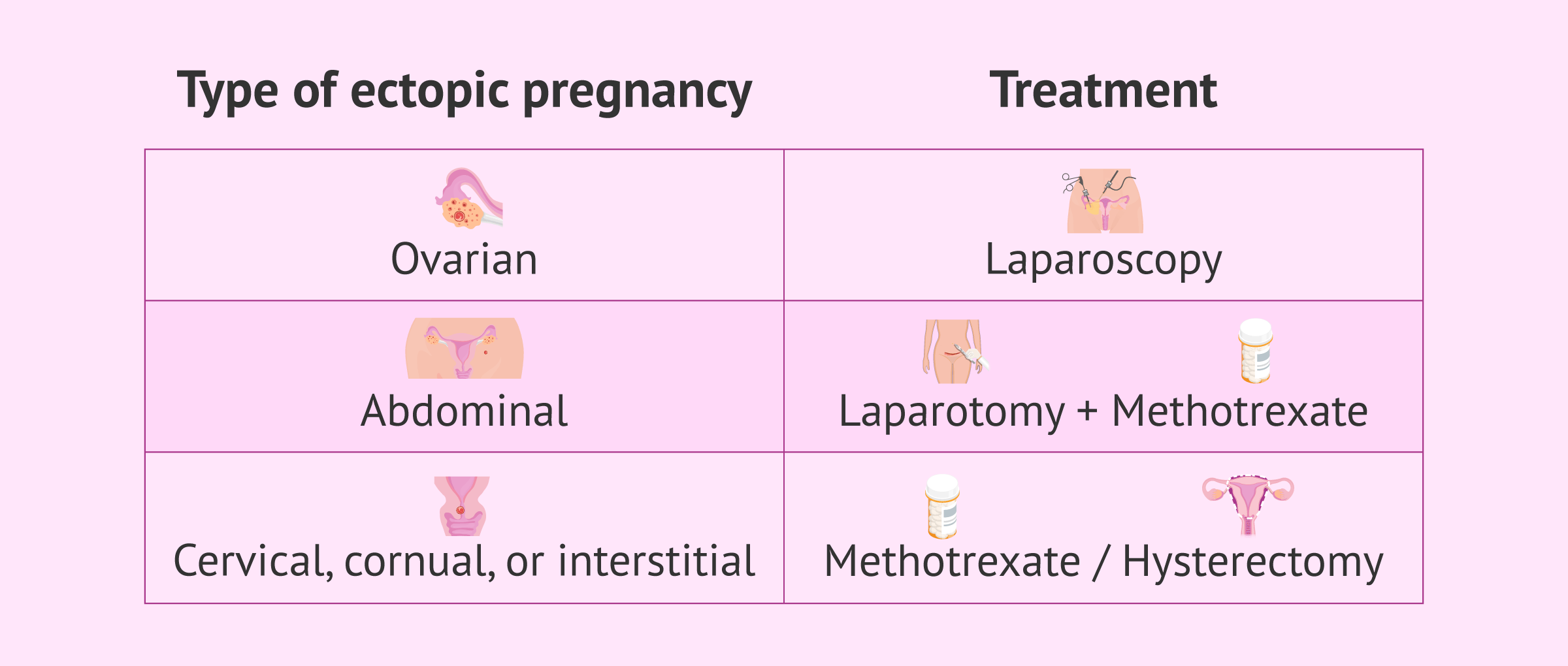 Imagen: Treatment based on the type of ectopic pregnancy