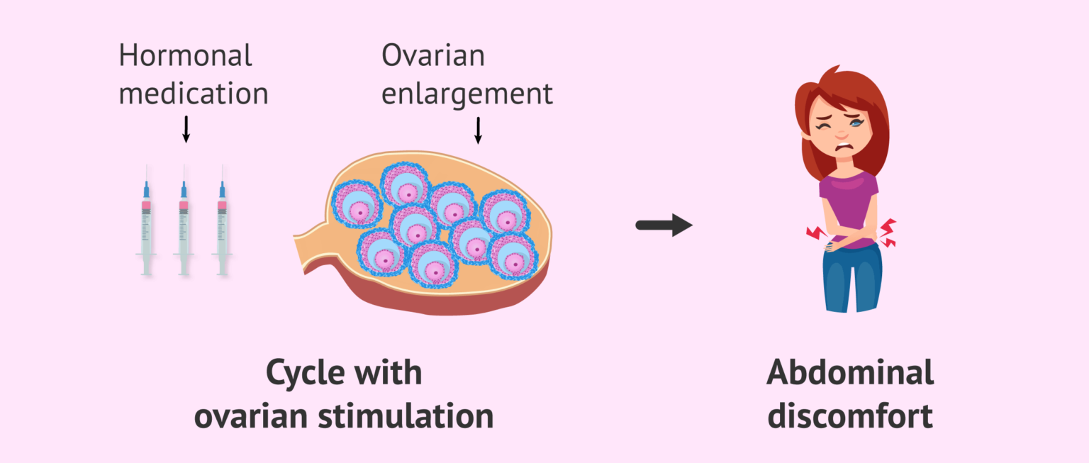 Discomfort from ovarian stimulation