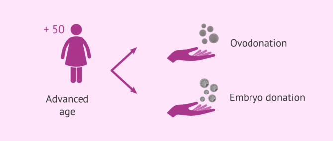 Imagen: Ovodonation in women at 50 years of age