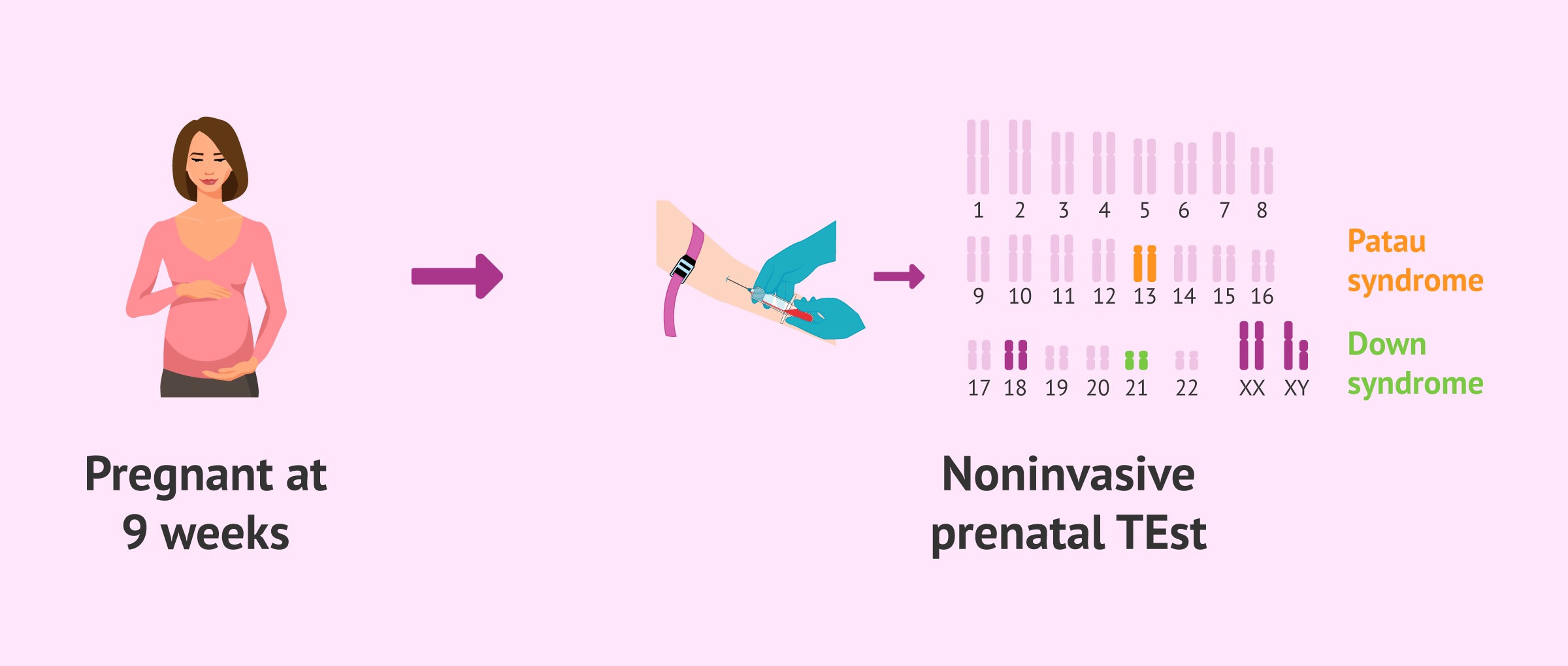 Imagen: Prenatal maternal blood test