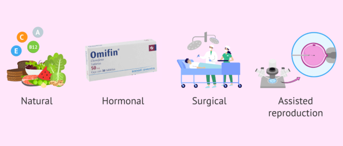 Imagen: Treatments for male infertility