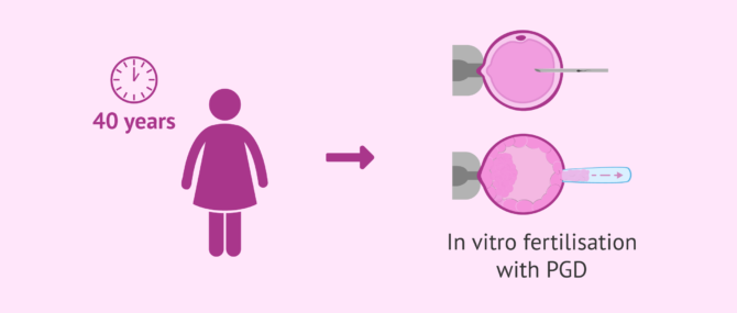 Imagen: IVF with PGD at age 40