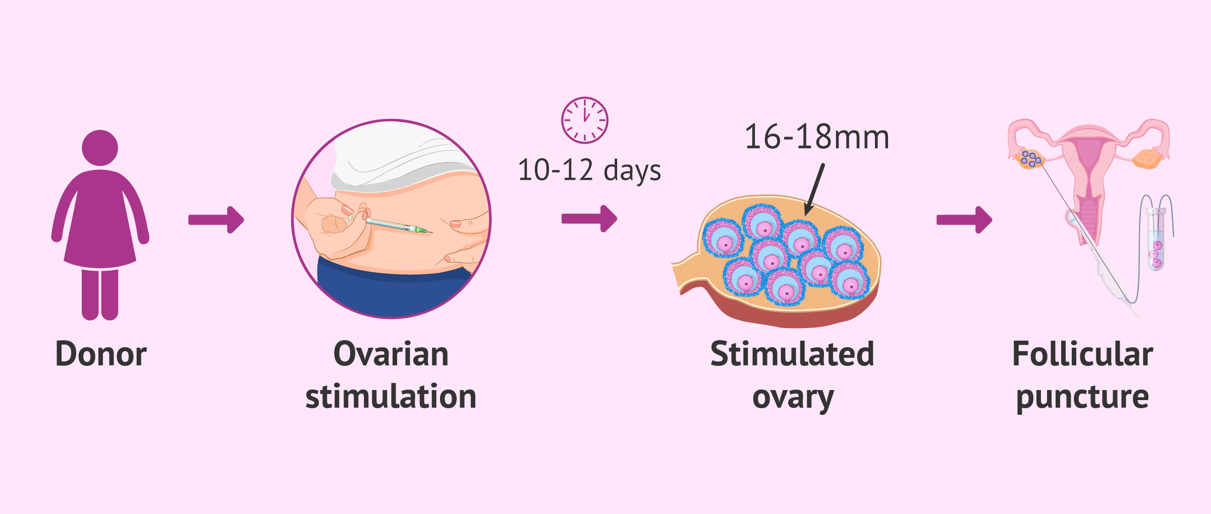 Donor ovarian stimulation process