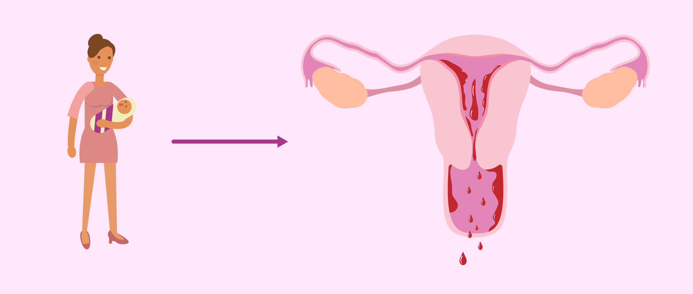 Period after childbirth