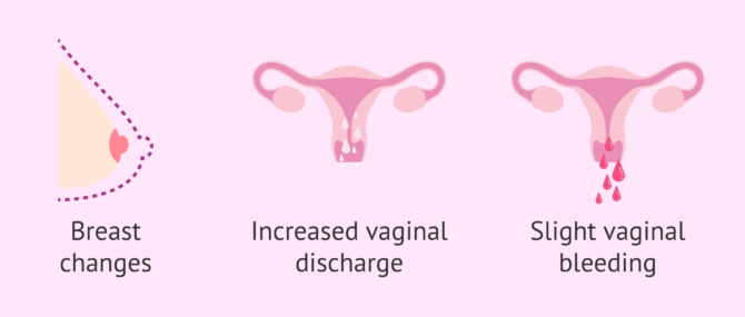 Imagen: First signs of pregnancy