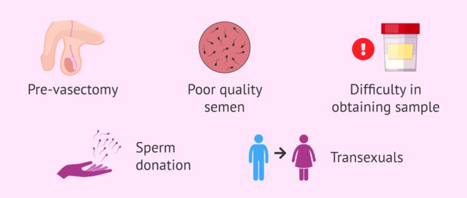 Imagen: When sperm freezing is recommended