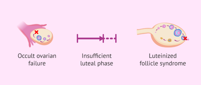 Imagen: Why can ovulation disturbances occur?