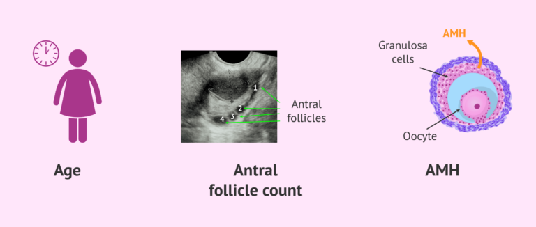 Anti-Müllerian hormone (AMH): its use in the study of fertility