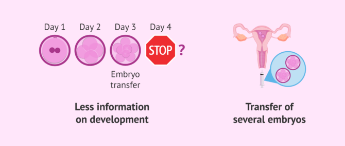 Imagen: Day 3 embryo transfer disadvantages