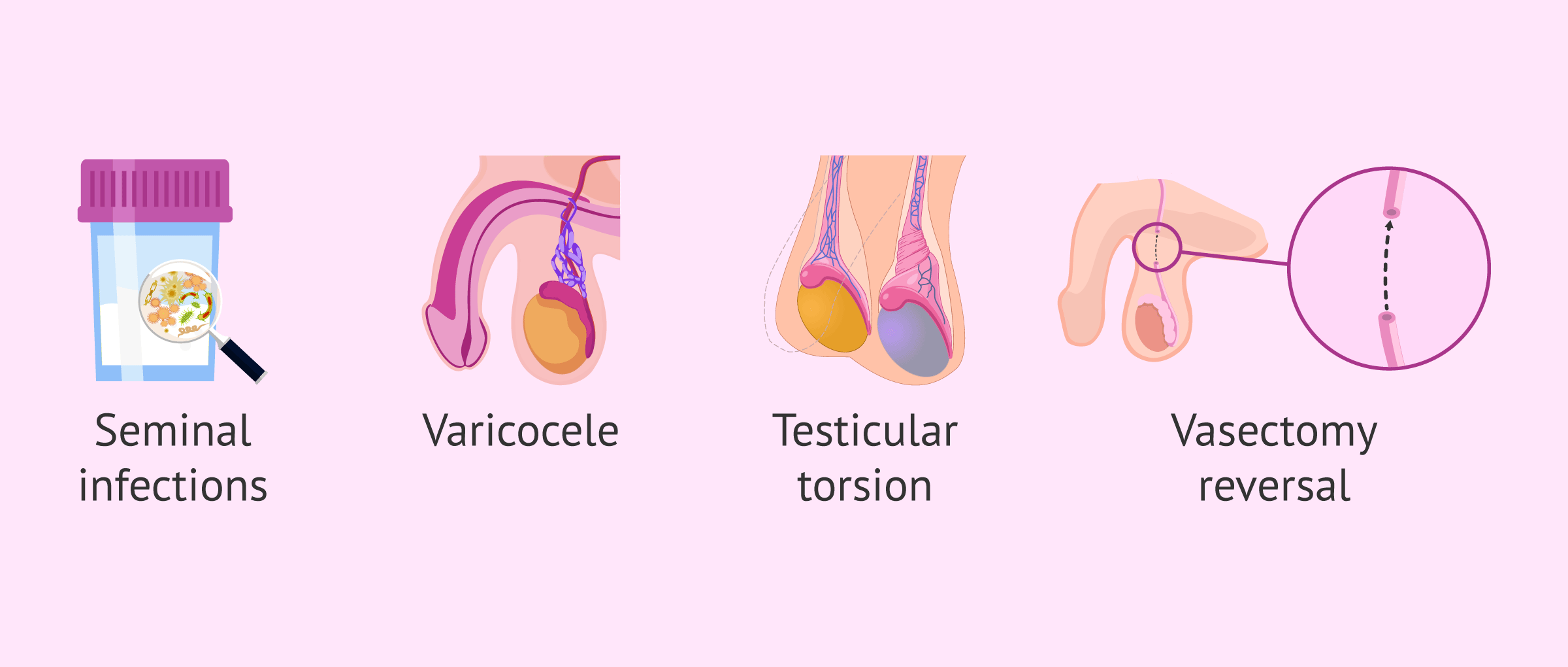 Imagen: Causes of blood-testicular barrier disruption