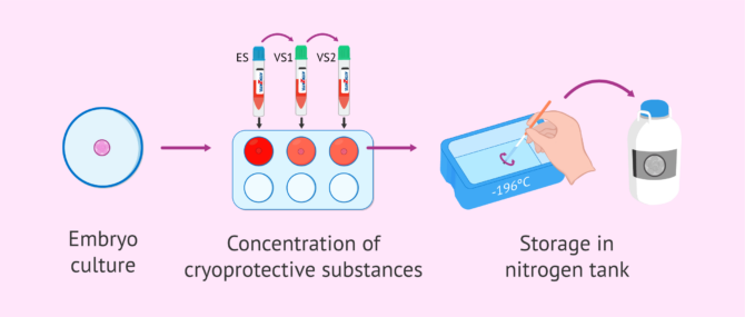 Imagen: Embryo vitrification process