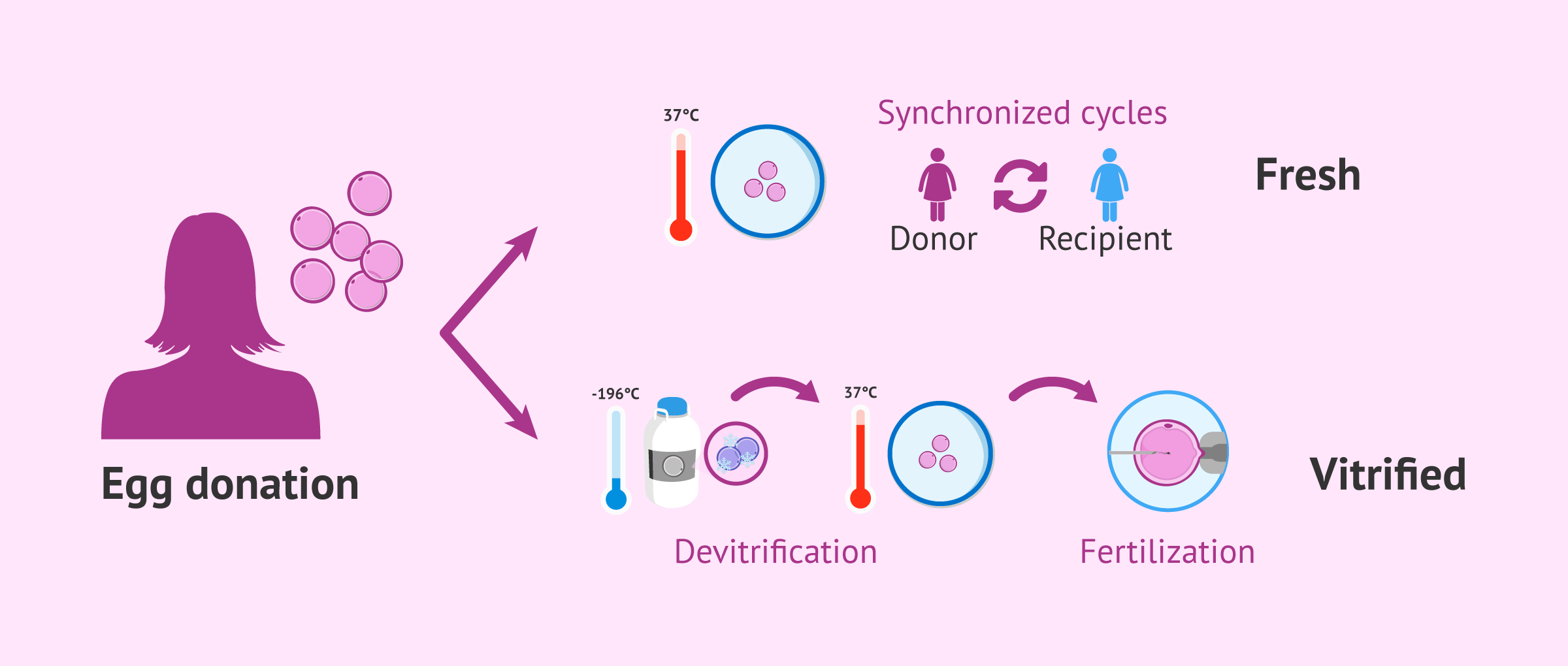Imagen: Difference between the use of fresh and vitrified donor eggs