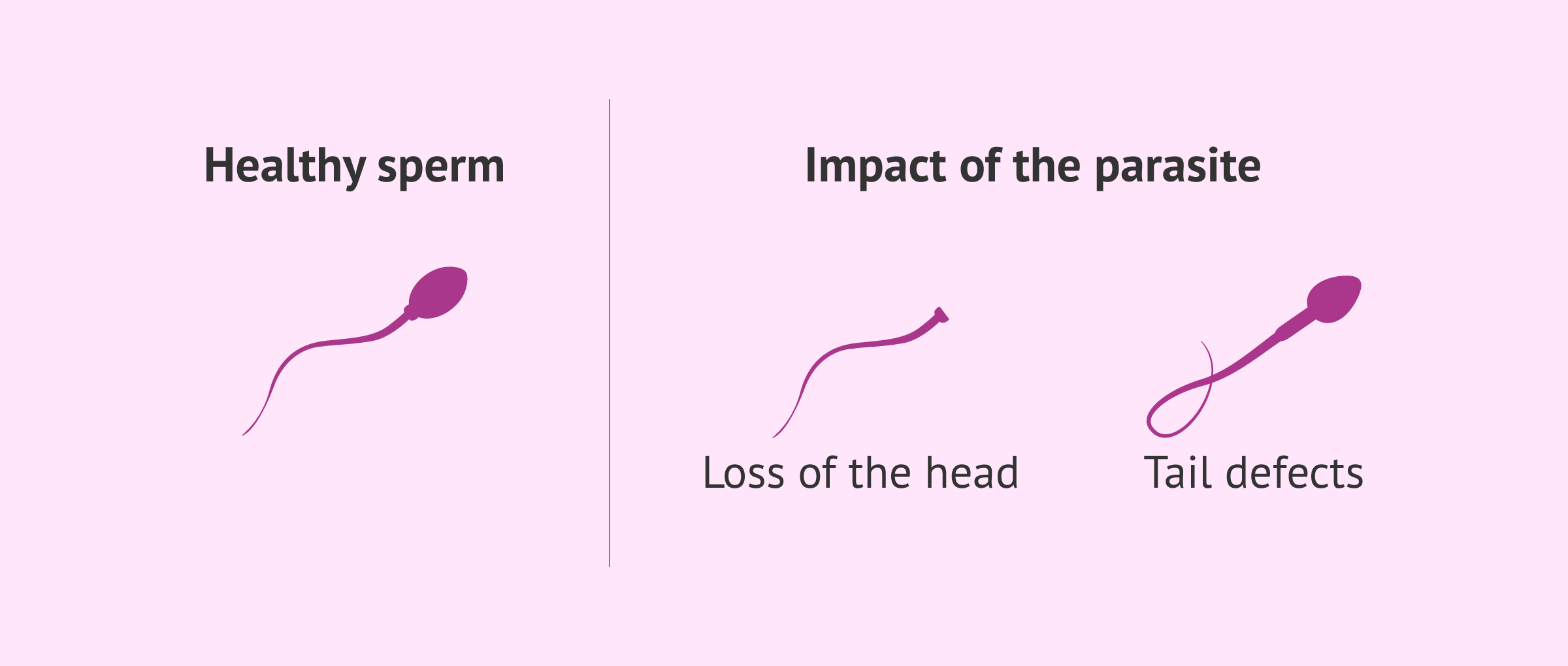 Imagen: Effects of toxoplasmosis on sperm
