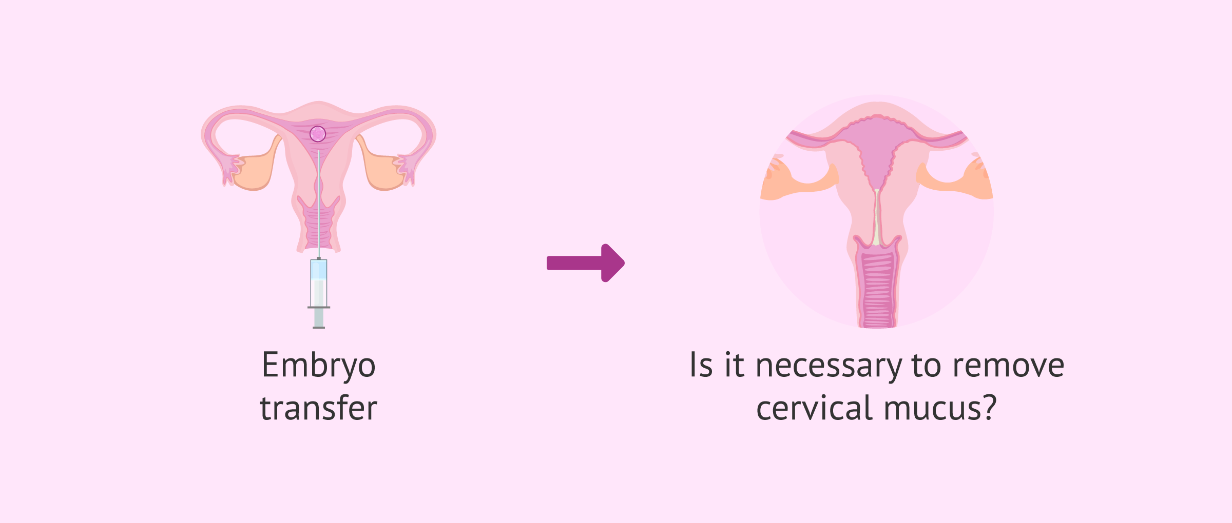 Clearing cervical mucus in IVF: Why this medical step is unnecessary
