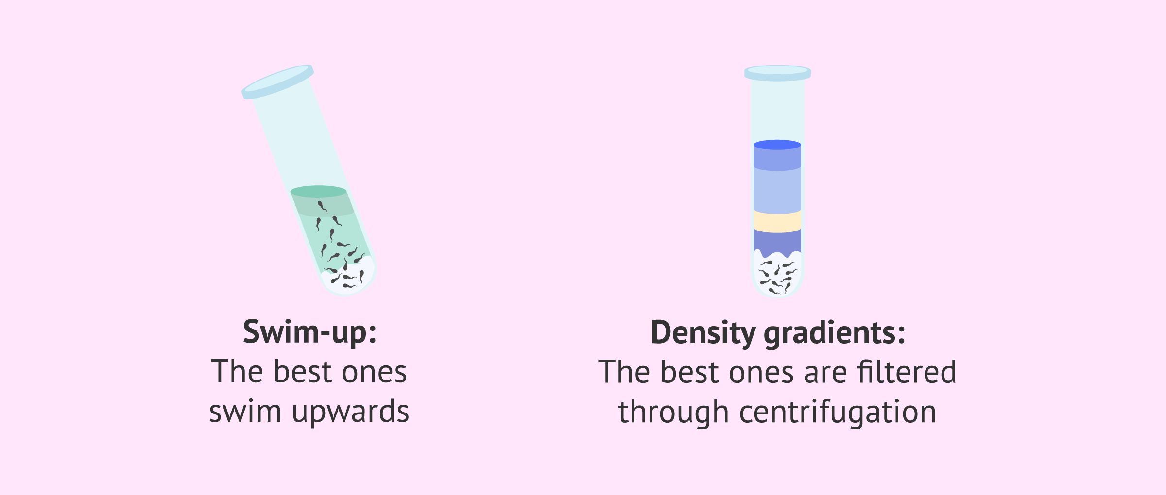 Imagen: Swim-up or gradients? Which is better?