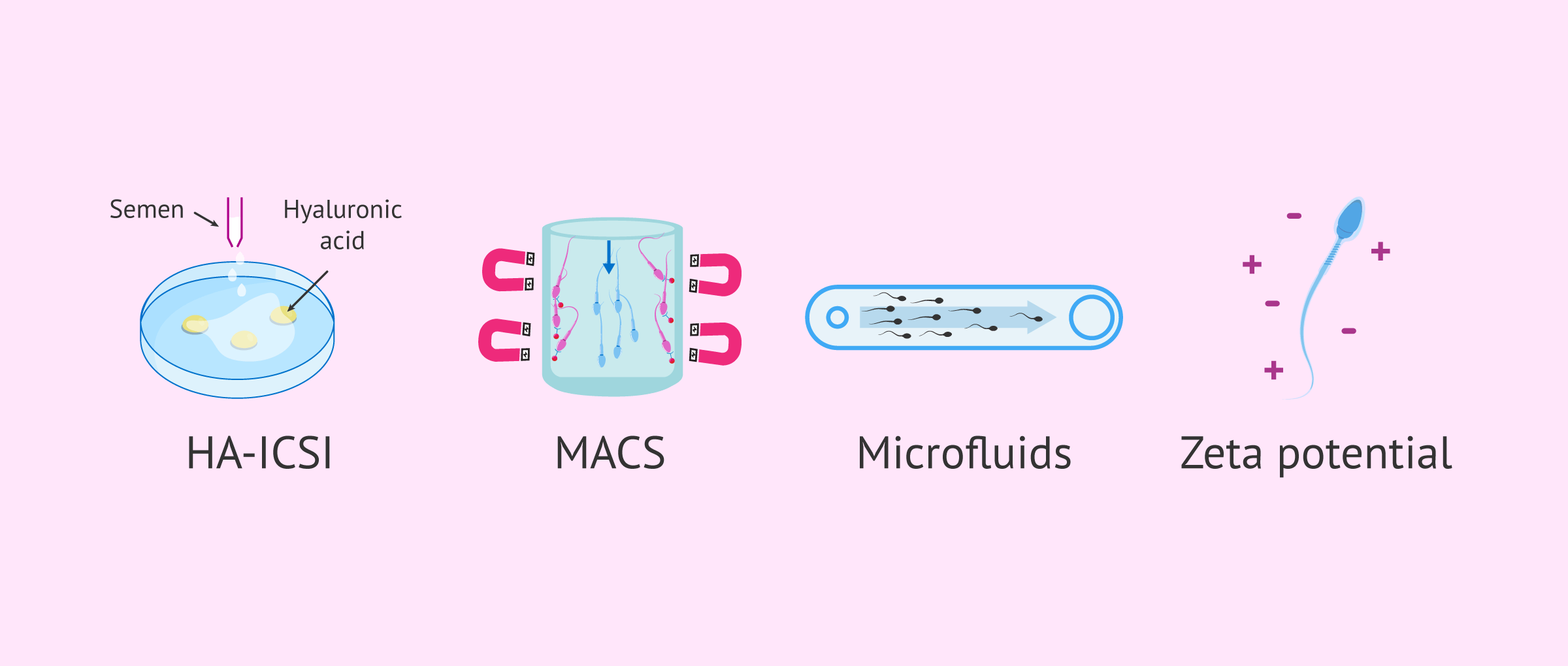 Imagen: Advanced sperm selection techniques