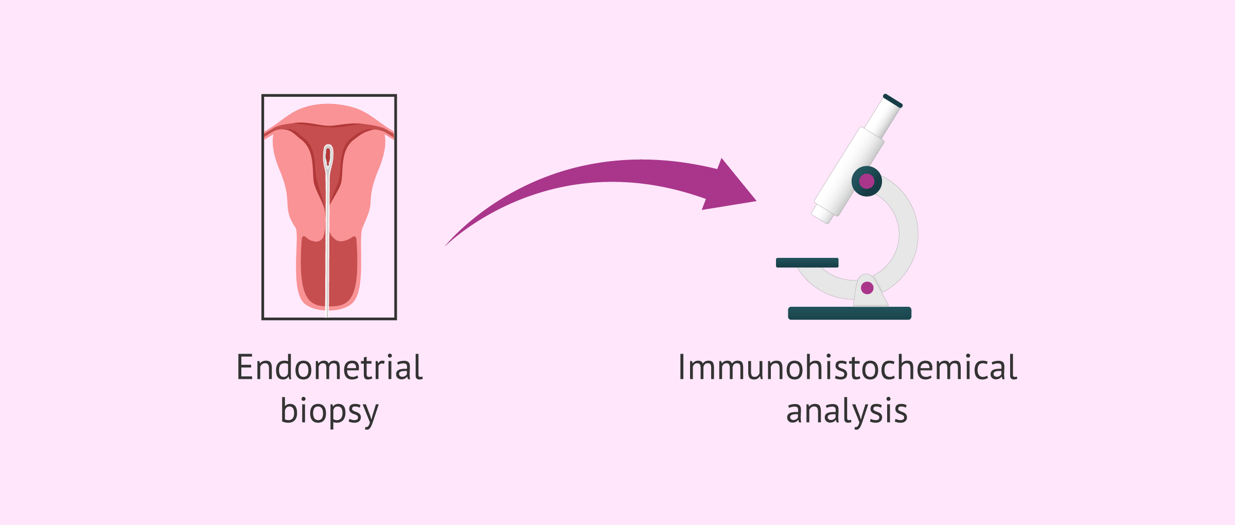 Imagen: Problems in diagnosing chronic endometritis