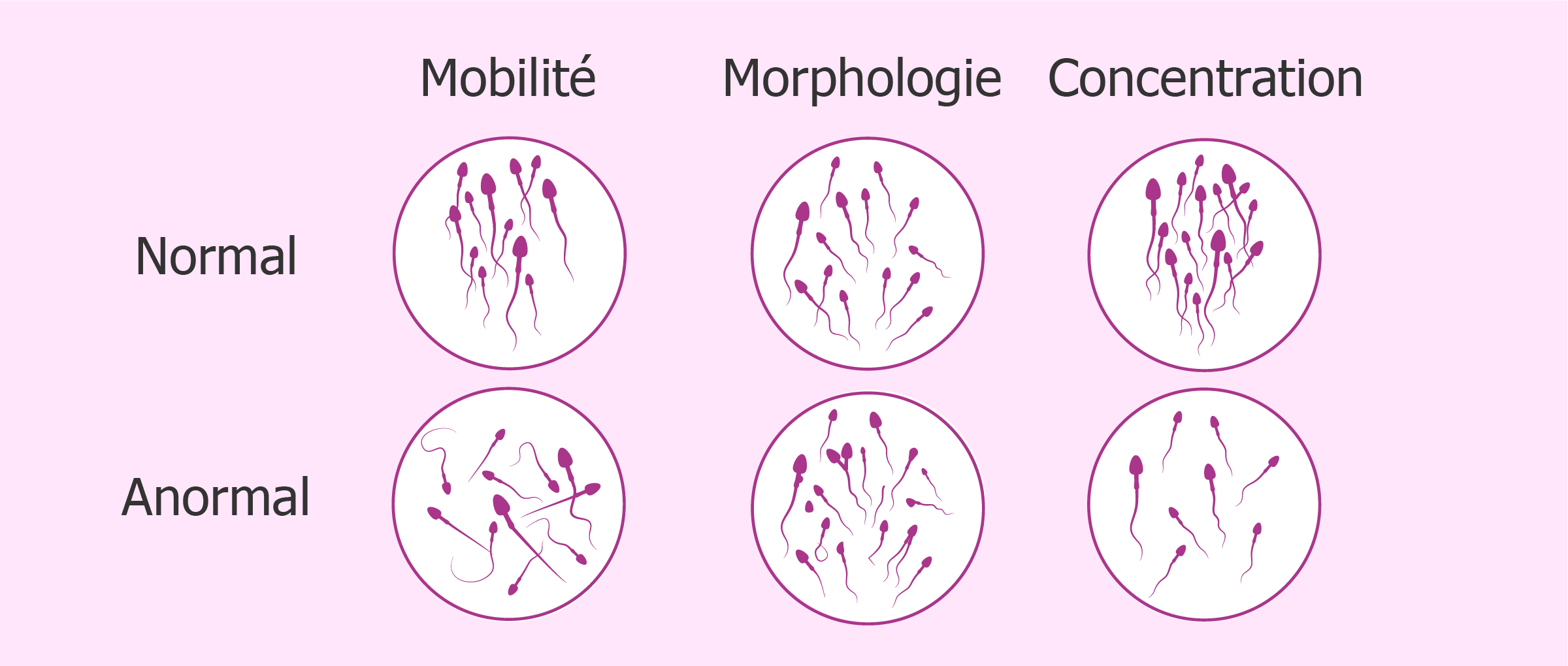 Problèmes de mobilité, morphologie ou concentration des spermatozoïdes