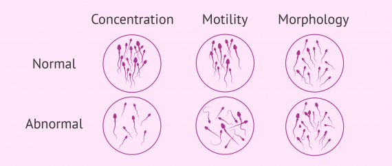 analysis Sperm motility semen